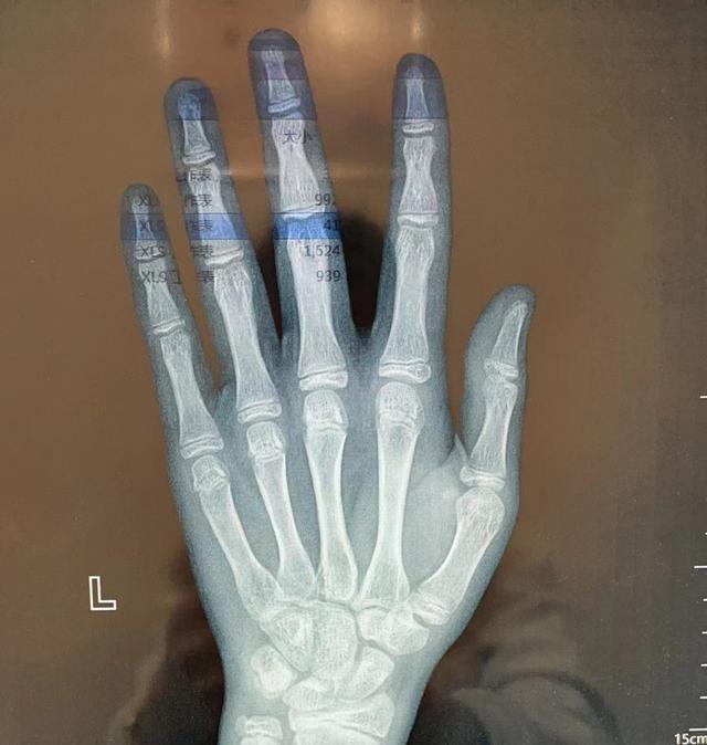 文章多高真实身高多少,文章多高(我们家孩子将来能长多高)