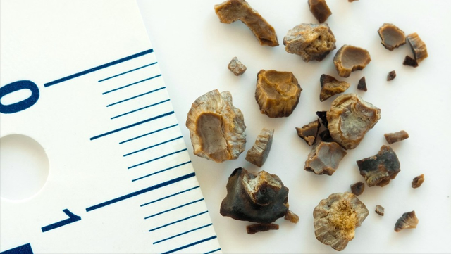 鸡内金片的功效与作用，鸡内金片的功效与作用和主治（每天吃鸡内金来消食健脾）