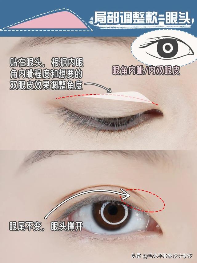 双眼皮贴的正确贴法图，怎样贴双眼皮贴（单眼皮肿眼泡快进来抄作业）