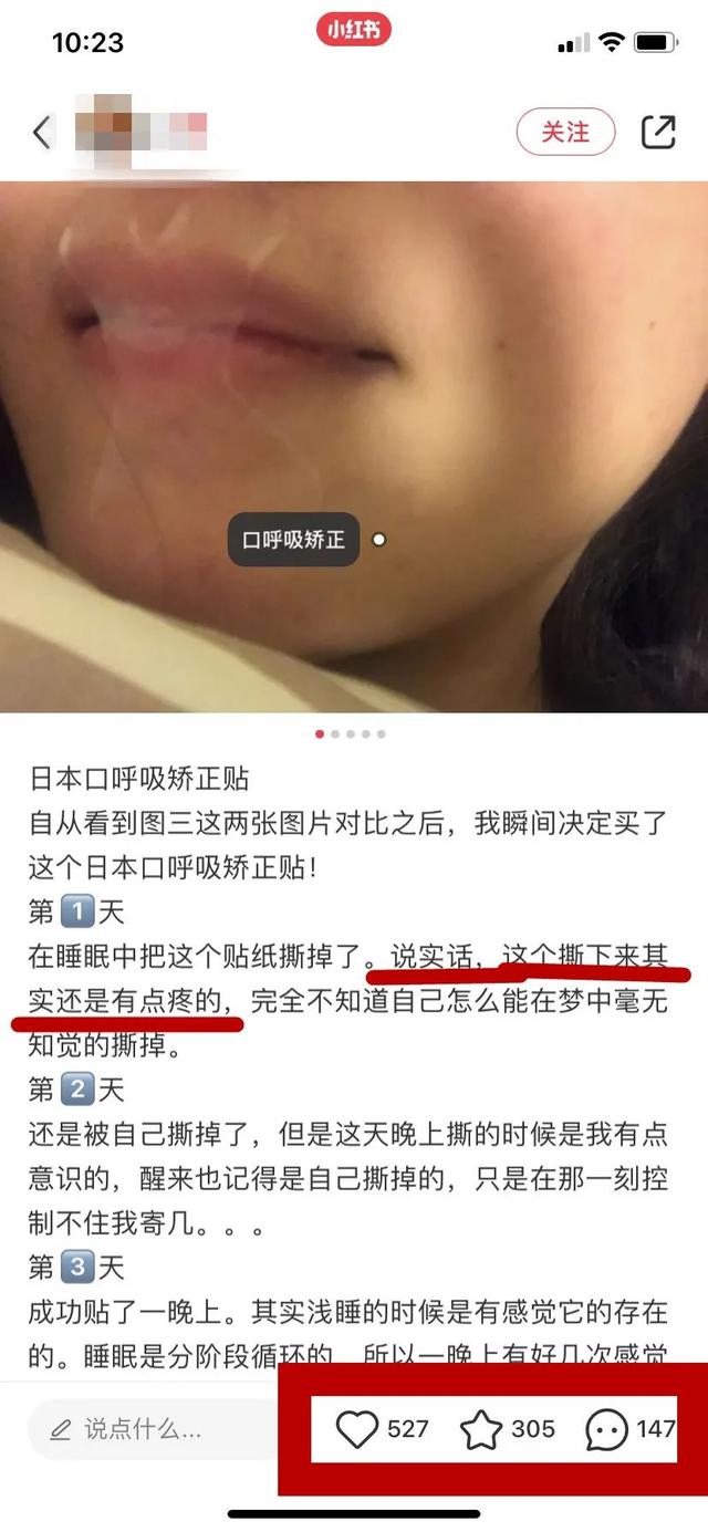 口呼吸嘴凸怎么矫正，口呼吸嘴凸怎么矫正视频（1亿人围观的口呼吸贴）