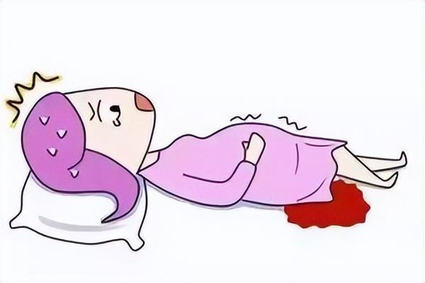 排卵期出血需要治疗吗?