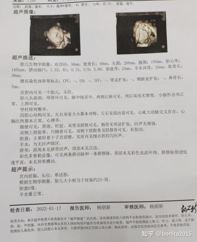 怀孕全过程是怎样的，怀孕的全程过程（2021年-2022年广州产检深圳生娃全流程）
