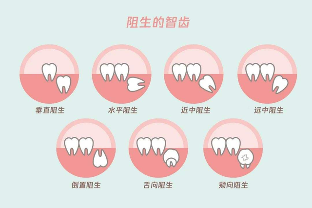 28颗牙齿结构图解剖图图片