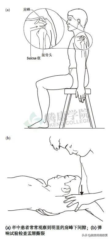 biceph，肩关节的特殊检查（bicep curl）