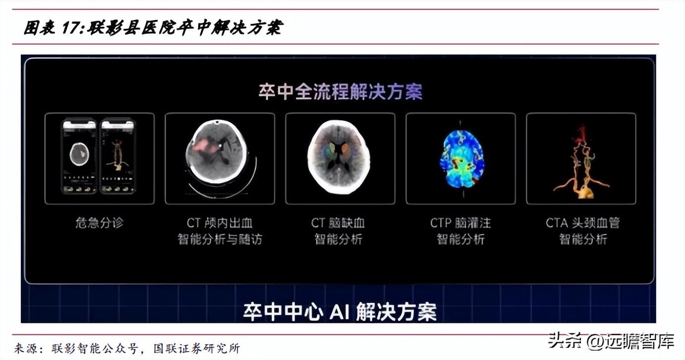 联影医疗（十年磨一剑）