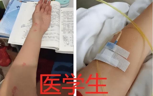 女生学医学影像学影响身体吗，女生千万不要学医学影像（看了她们上课的日常状态）