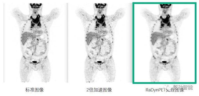 孕期检查时间，孕妇做检查时间表（备孕与妊娠期间进行影像检查应注意哪些事项）