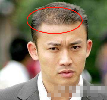 秃头西装男表情包(12位大神级别男星) - 赤虎壹号