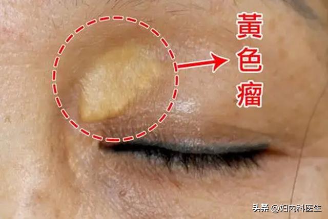 脸黑是什么病，脸黑是什么病症（如何通过脸色表情判断身体的毛病）