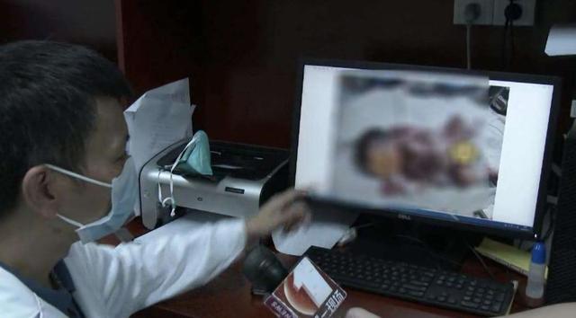 生孩子是从哪个部位生出来的，宫外孕的概率有多大（注定被“割”下的寄生胎）