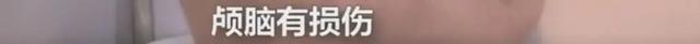 本宝宝不开心图片，小孩不开心的图片（30天宝宝脑损伤、3岁宝宝被勒断肠……）