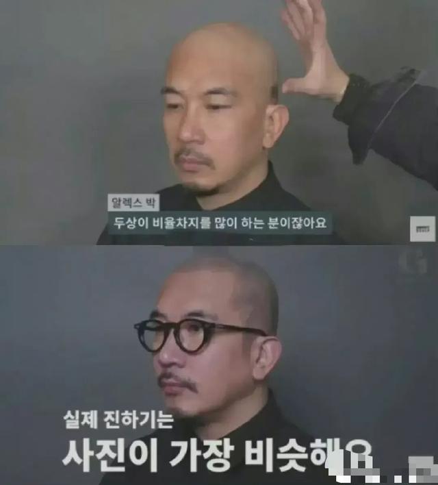 发量少怎么办，这样做发量分分钟旺盛给你看！（秃星人如何秒变发量王者）