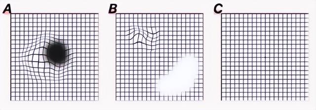 右眼睛跳动是代表什么意思，右眼跳是什么兆头（或是癌症或疾病的预警）