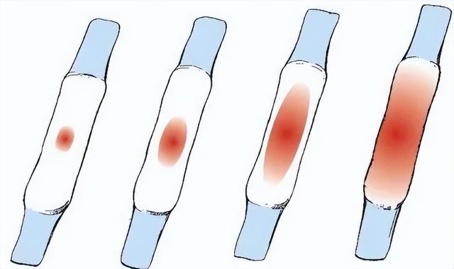 身体有异味是什么原因女性，女人身上异味重原因（都是从生完娃开始的）