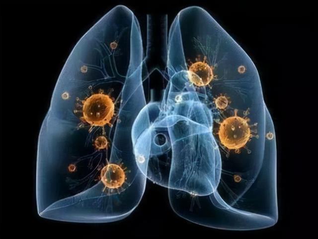 新冠肺炎早期症状，新冠肺炎早期症状会发冷吗（新冠肺炎的潜伏期有多长）