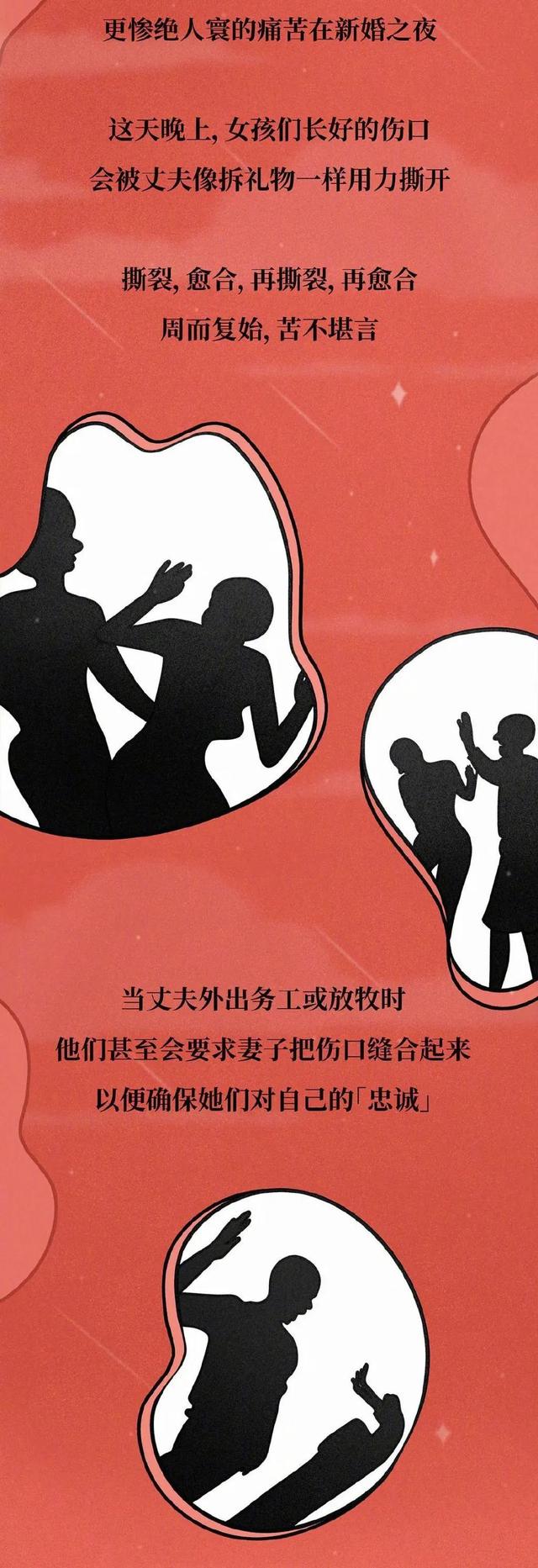 ​玛丽苏是什么意思，玛丽苏名字男名（女性“割礼”，到底有多残忍）