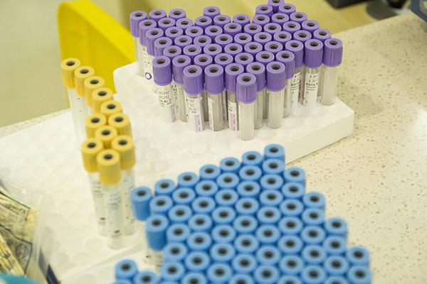 阴道镜检查疼吗，做阴镜一般都查什么病（医生：有2类人）