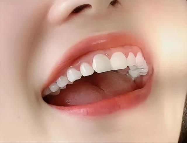 牙粉的使用方法，每天几毛钱就能轻松解决