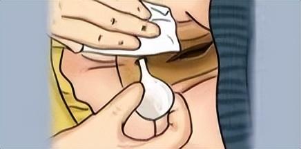 开塞露一次用多少，宝宝用开塞露一次多少（开塞露正确的功效、用法在这里）