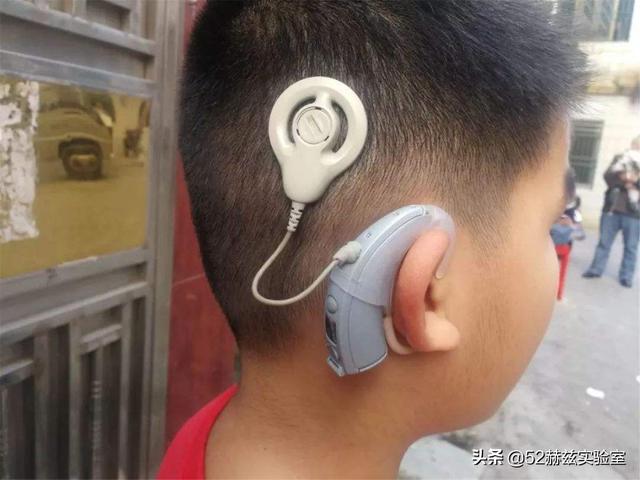 耳蜗的作用是什么，耳蜗的主要功能是什么（进口人工耳蜗30万）