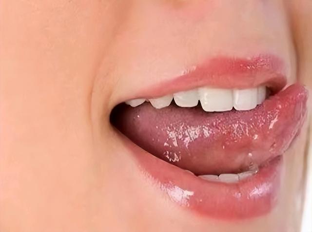 嘴巴经常长口腔溃疡什么原因，嘴巴经常溃疡是什么原因（口腔溃疡反复发作）