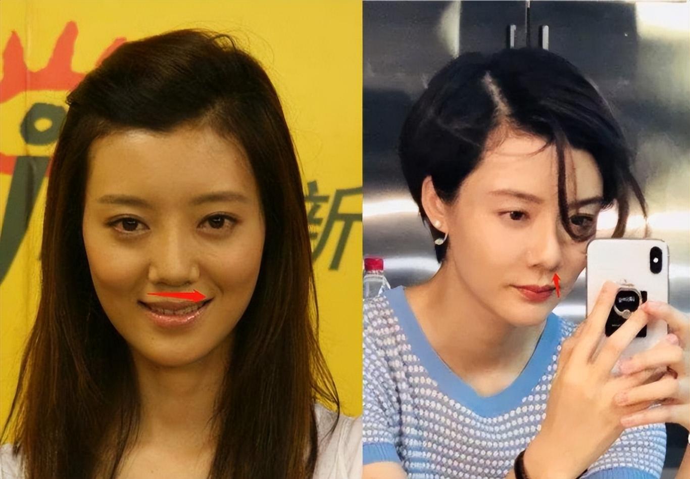 高山鼻——车晓曾经几何车晓,也算是无数人心中的女神,本身身材高挑