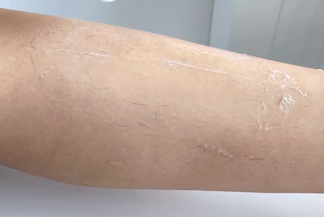 薇婷脱毛膏正确使用方法，薇婷脱毛膏正确使用方法图解（5款爆火脱毛产品真人实测）