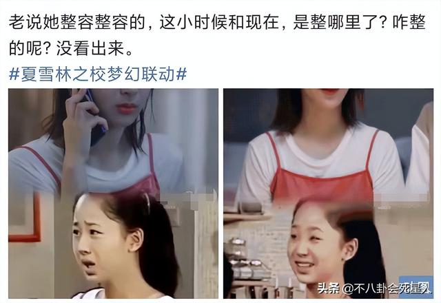 整容后遗症有哪些，整容后遗症有哪一些（明星整容后遗症明显）