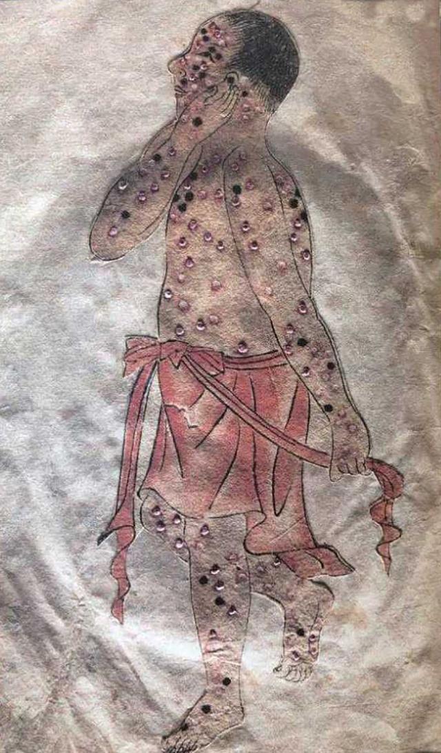 霍乱历史上爆发了几次，霍乱的历史事件（历史上最著名的六大传染病）