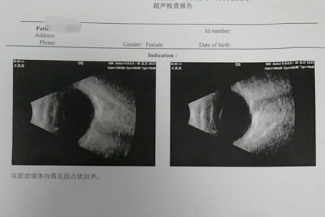 左眼睛一直跳预示什么，左眼跳财,右眼跳灾是真的吗（眼前浮现小黑影）