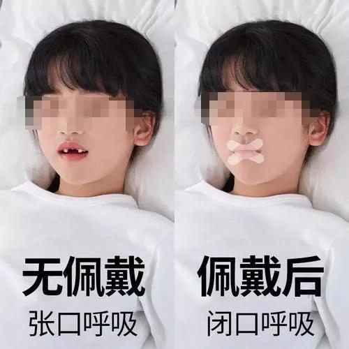 儿童睡觉微微张嘴但用鼻呼吸，孩子睡觉微微张嘴正常吗（宝宝睡觉张口呼吸，一定要注意）