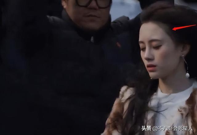 杨幂的发际线是什么样的，14位明星增发妙招