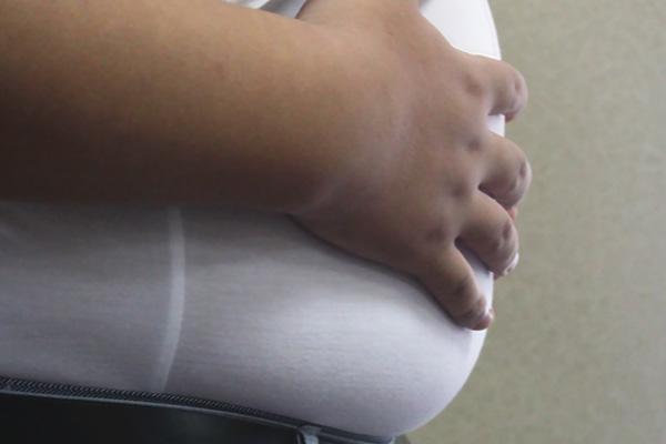 男性睾酮低怎么办，睾酮低怎么办（身体4处变化暗示异常）