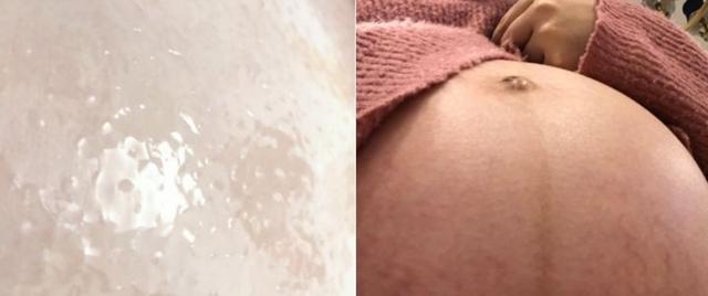 祛妊娠纹的最好产品，去妊娠纹用什么牌子的产品好（盘点5款”零差评“妊娠油/霜）