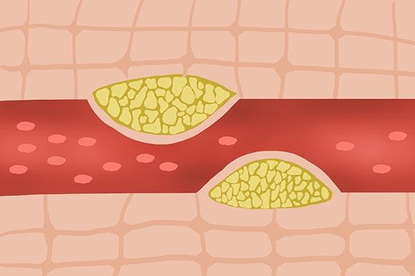 怕冷是什么原因，特别怕冷是什么原因（膝关节怕冷，是什么原因）