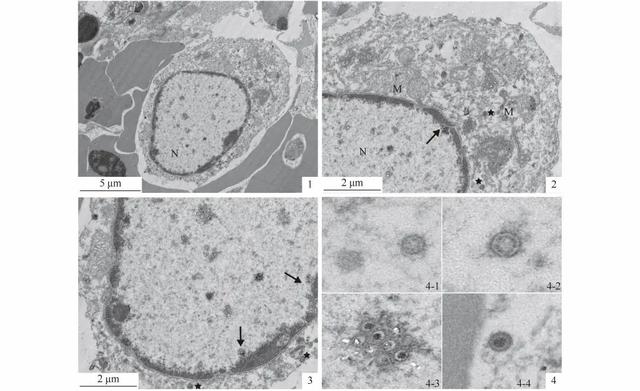dpbs和pbs的区别，pbs缓冲液配制（四川地区养殖鲫鲤疱疹病毒Ⅱ型的鉴定及病理学研究）