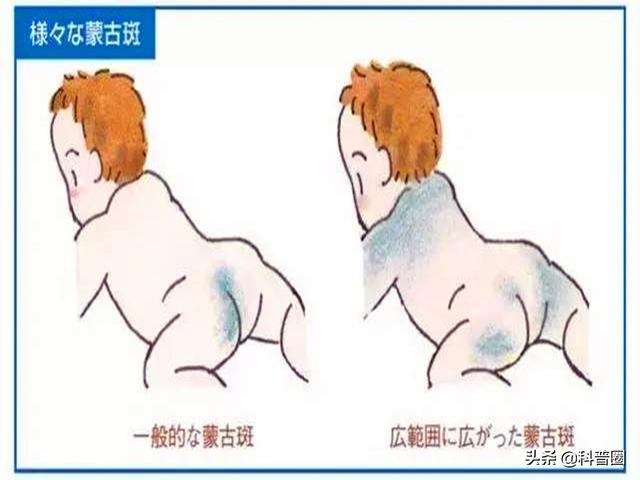 蒙古褶，为何被称“黄种人”（蒙古褶皱）