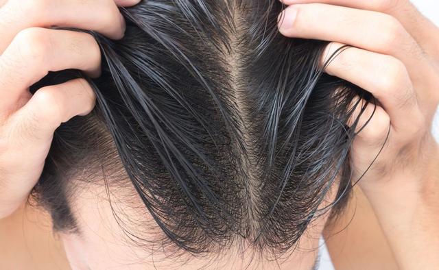 什么时候洗头发最好，洗头发哪个时间最好（多久洗一次头发比较好）