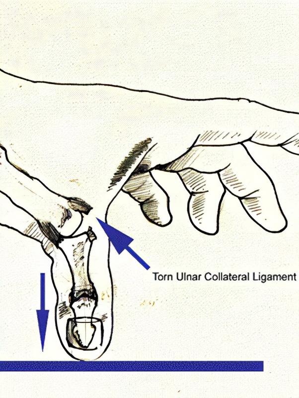 滑雪单板和双板哪个难，滑雪单板容易还是双板好学（你选单板or双板）