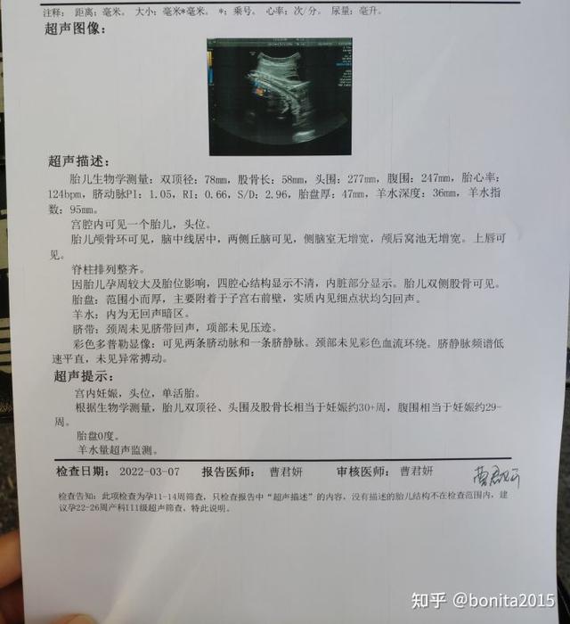 怀孕全过程是怎样的，怀孕的全程过程（2021年-2022年广州产检深圳生娃全流程）