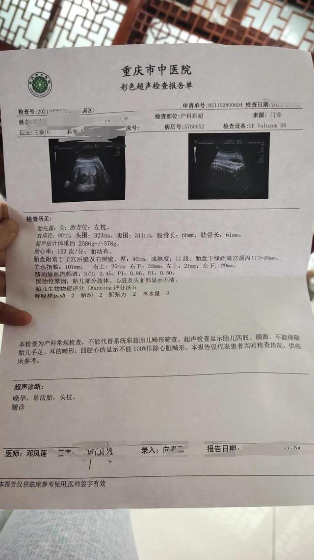 怀孕多少周生产，怀孕多少周后能生产（关于怀孕那些事——我的生产经历）