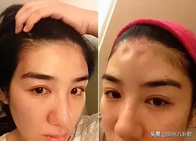 黄奕出轨事件知乎，黄奕被前夫家暴（为抢富豪男友撕破脸）