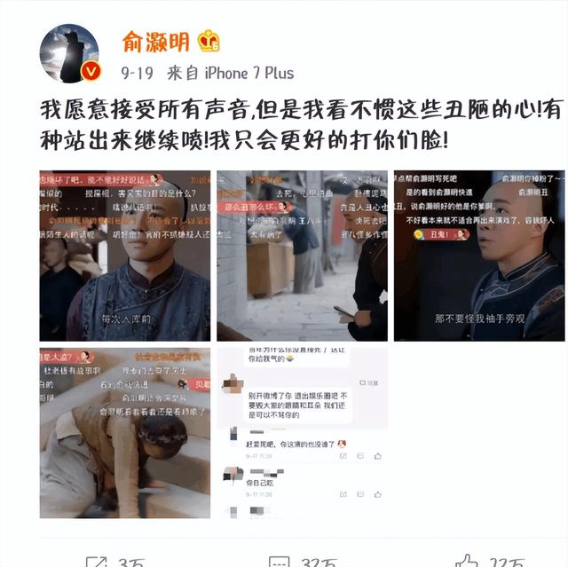 俞灏明毁容前和毁容后，再到摘掉“糊咖”的帽子