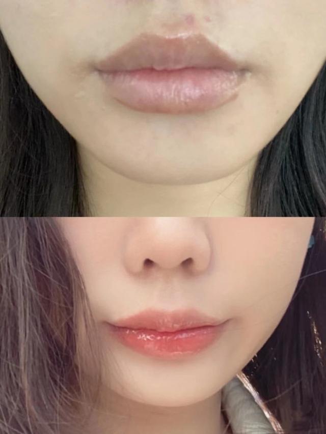 唇的形状有哪些，唇形有哪些（告别薄唇、下垂唇、厚唇形）