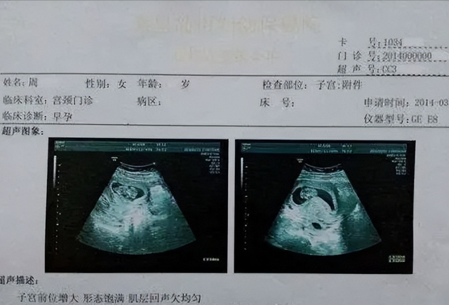 怀孕1一9月腹部变化图，怀孕1一9月子宫位置图（可以从孕期症状看出胎儿性别）