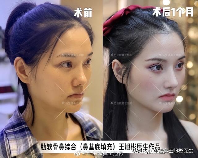 高级脸是什么意思，6种脸型不显老（“月亮脸”逆袭“高级脸”的不二法则是）