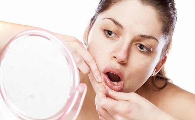 脸上闭口粉刺多怎么办，满脸都是闭口粉刺怎么办（今蝉护肤：闭口粉刺怎么去除）