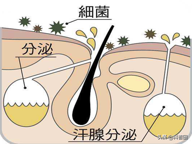 狐臭是怎么引起的，女生狐臭是怎么引起的（科学证实：有狐臭正常）