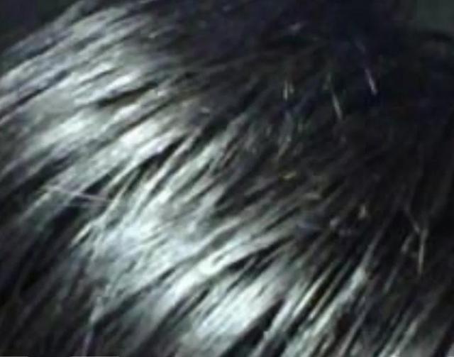 头发油怎么办快速解决，头发出油怎么办（头发油该怎么解决）