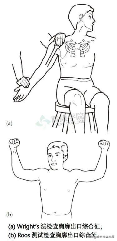 biceph，肩关节的特殊检查（bicep curl）